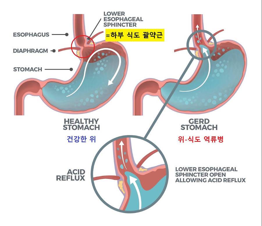게시글 사진
